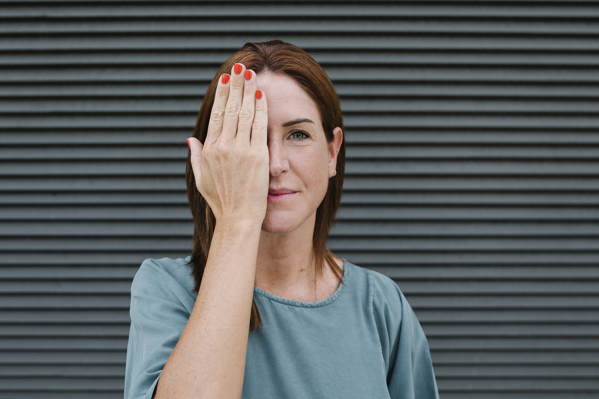 Woman covering one eye with her hand